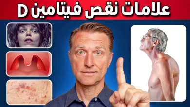 علامات نقص فيتامين د الصامتة التي يجب الانتباه لها